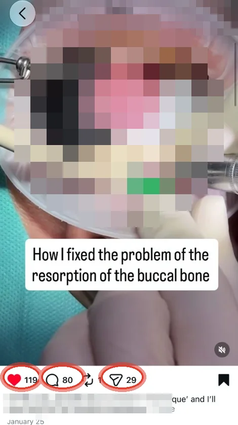 Technique Reel with 119 likes and 80 comments. Clinical field and name pixelated.